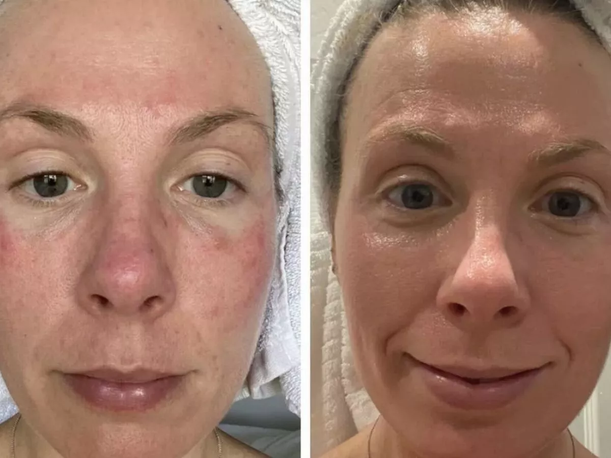 NHS doctor's multi-award-winning cream for mature skin 'takes just one use to work'