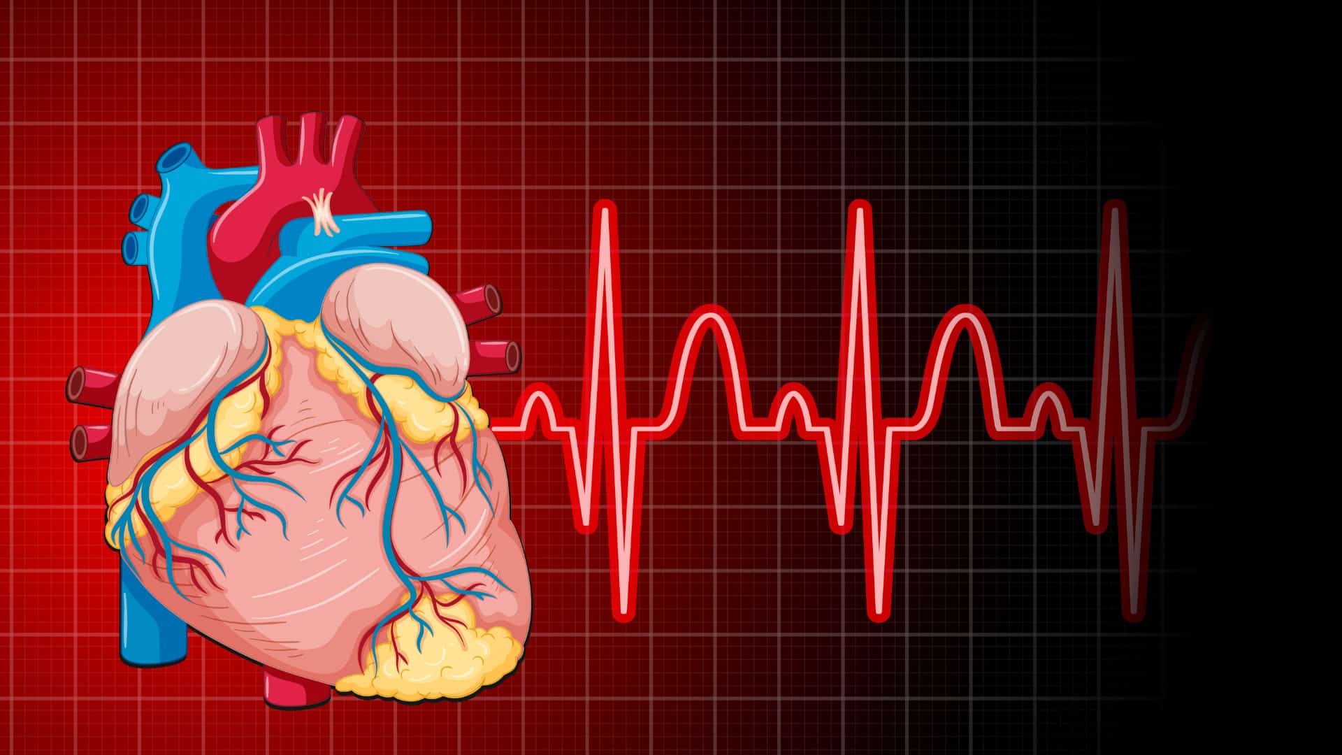 69-year-old woman recovers after successful leadless pacemaker implant