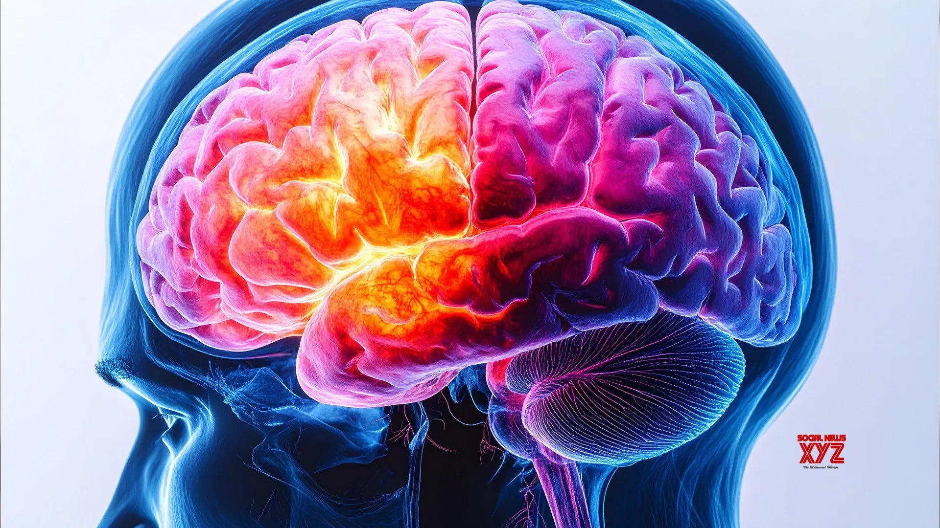 Tongue may hold clues to detect, track motor neurone disease: Study