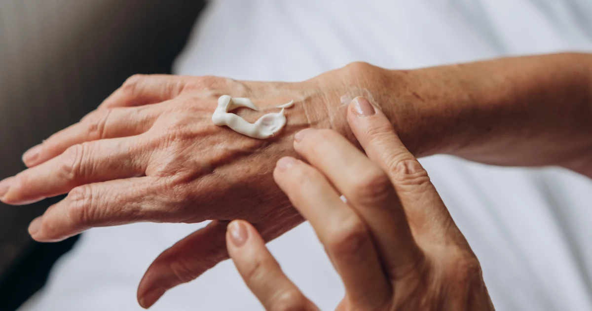 Home Wart Treatments, According to Experts