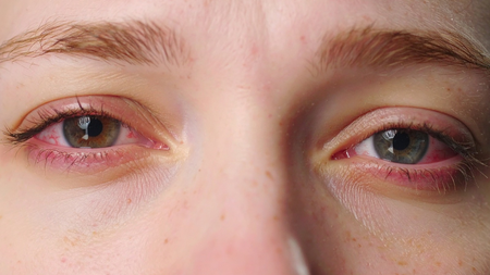 City doctors report 50 pc rise in eye problems as smog continues to engulf Delhi