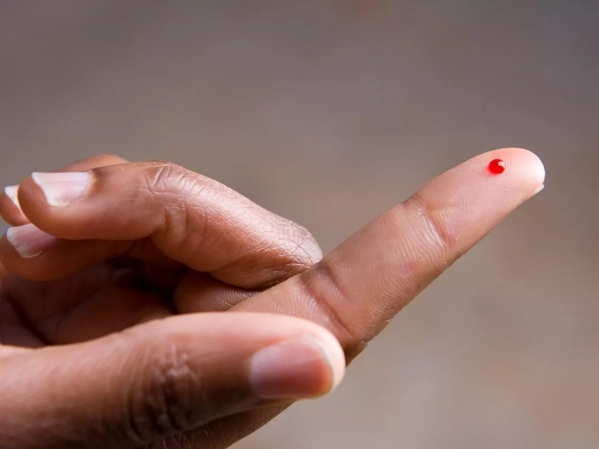 NHS random blood testing in A&Es uncovers shocking numbers with undiagnosed HIV