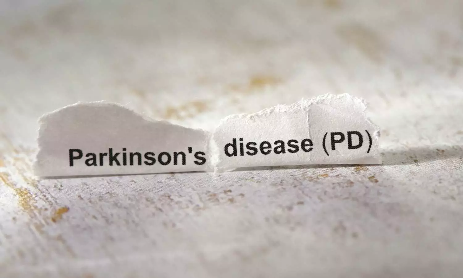 No Evidence That Appendix Removal Influences Parkinson’s Disease Development: Meta-Analysis