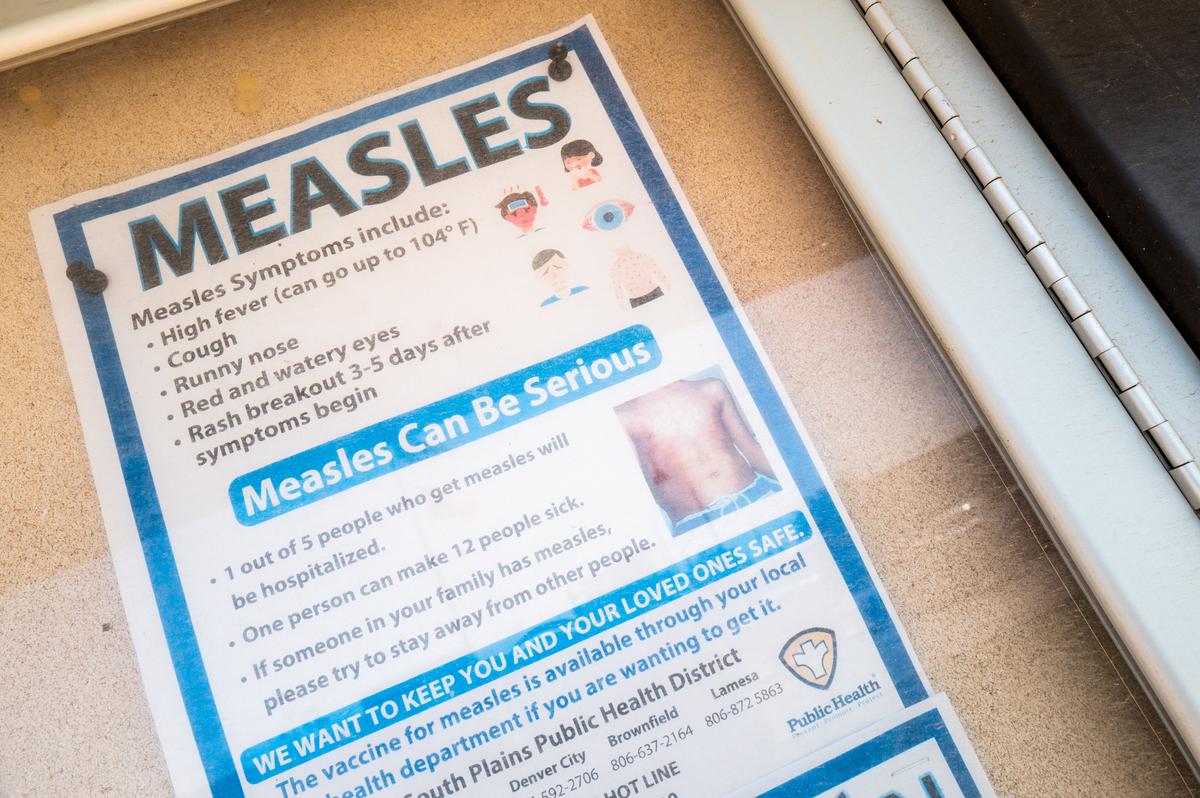 Measles Outbreak Grows to Three Cases in Olmsted County