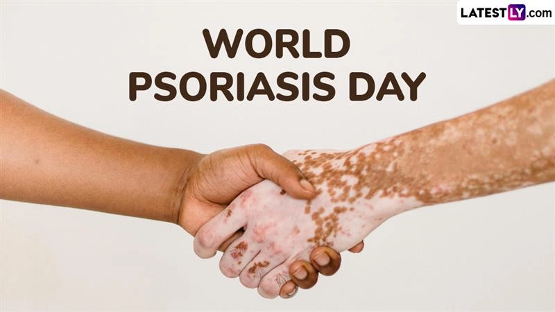 World Psoriasis Day 2025: Date, Theme, History, Significance of the Day Raising Awareness About the Autoimmune Skin Condition