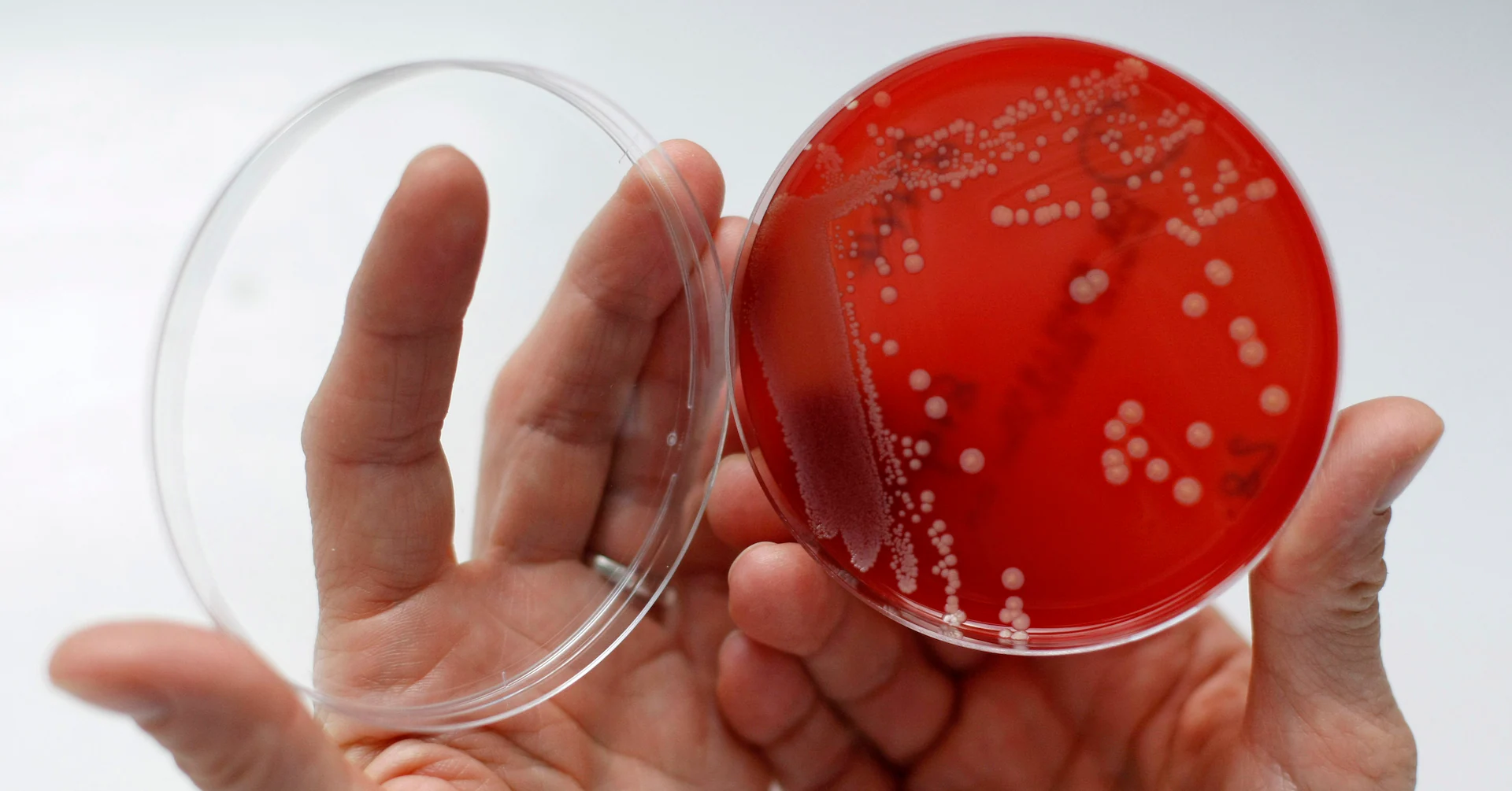 Health Rounds: Viruses may hold key to tackling deadly bacterial infection