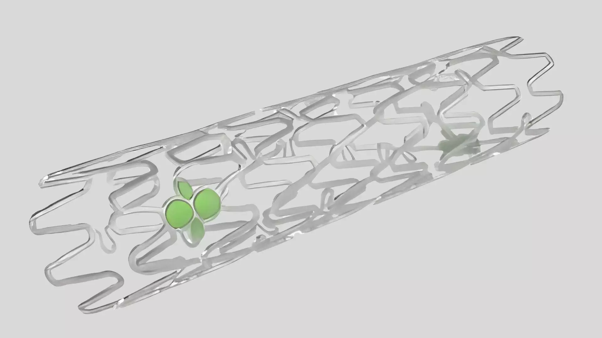 IRONMAN-II Trial Evaluates Two-Year Outcomes of Sirolimus-Eluting Iron Bioresorbable Scaffold Versus Everolimus-Eluting Stent: TCT 2025