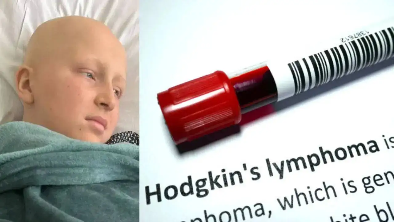 Teenager Told Neck Lump Was Tonsillitis, Later Diagnosed with Stage 4 Hodgkin Lymphoma Cancer