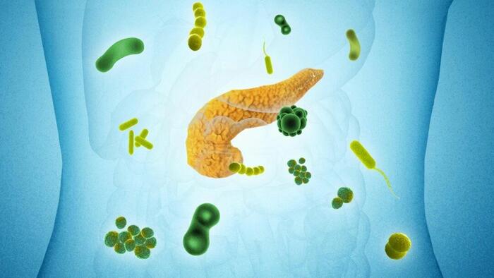 27 Microbes Linked To Pancreatic Cancer, Major Study Finds