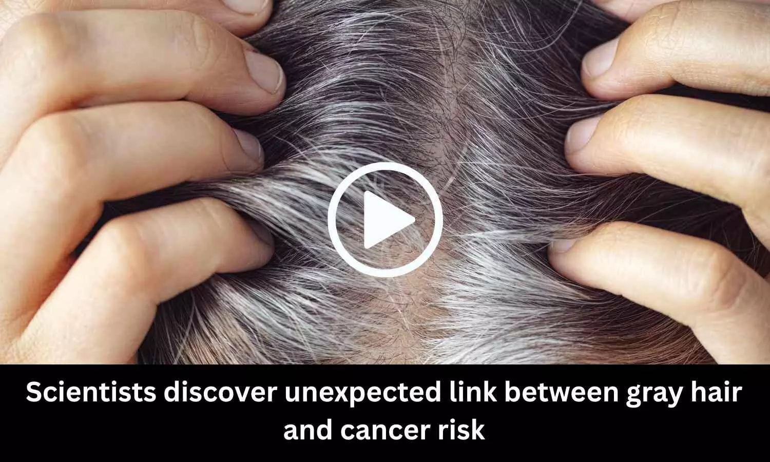 Scientists discover unexpected link between gray hair and cancer risk