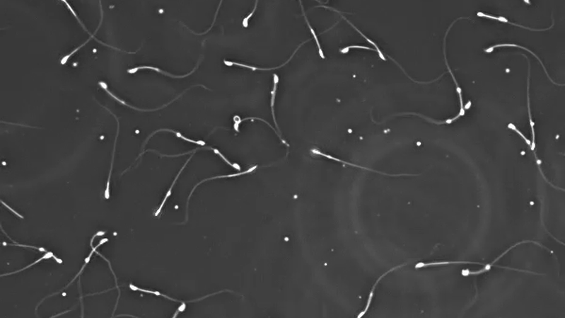 The great sperm mystery: How doctors hope to solve unexplained male infertility