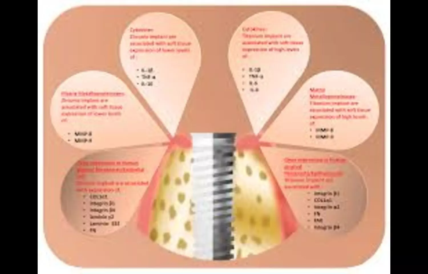 Both Zirconia  and Titanium Abutments show comparable Tissue Response and Volume Stability: Study