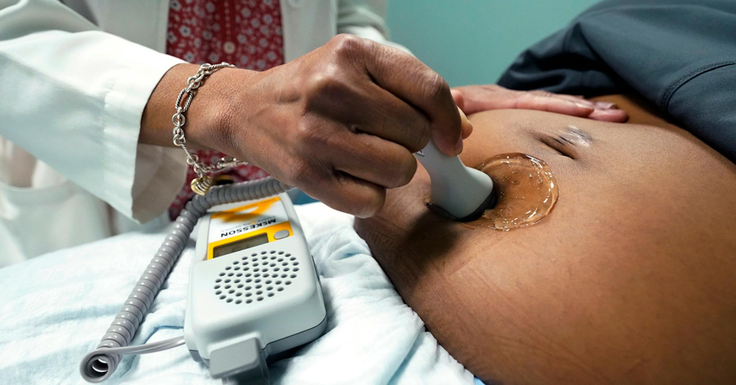 COVID in pregnancy tied to autism, developmental issues, study says