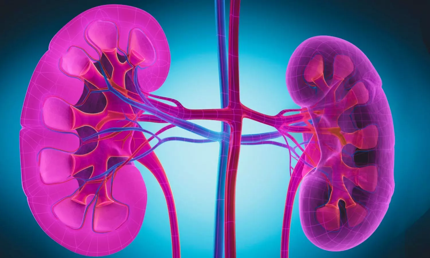 FDA Approves  Obinutuzumab for Active Lupus Nephritis