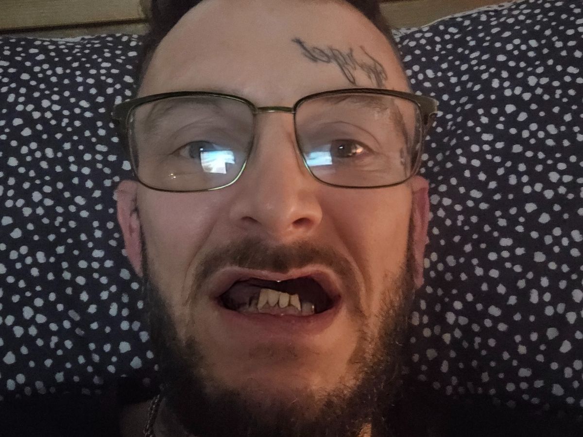 NHS dentists crisis sees surge in GoFundMe appeals from desperate people in pain