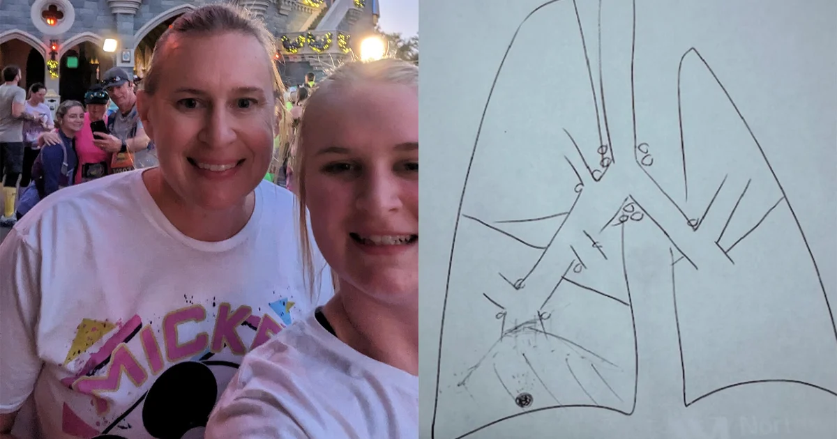 Broken limb leads to non-smoker's lung cancer diagnosis years later