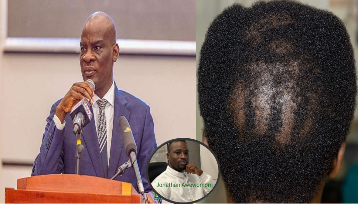 Modern minds, outdated rules? Should SHS students be allowed to keep their hair?