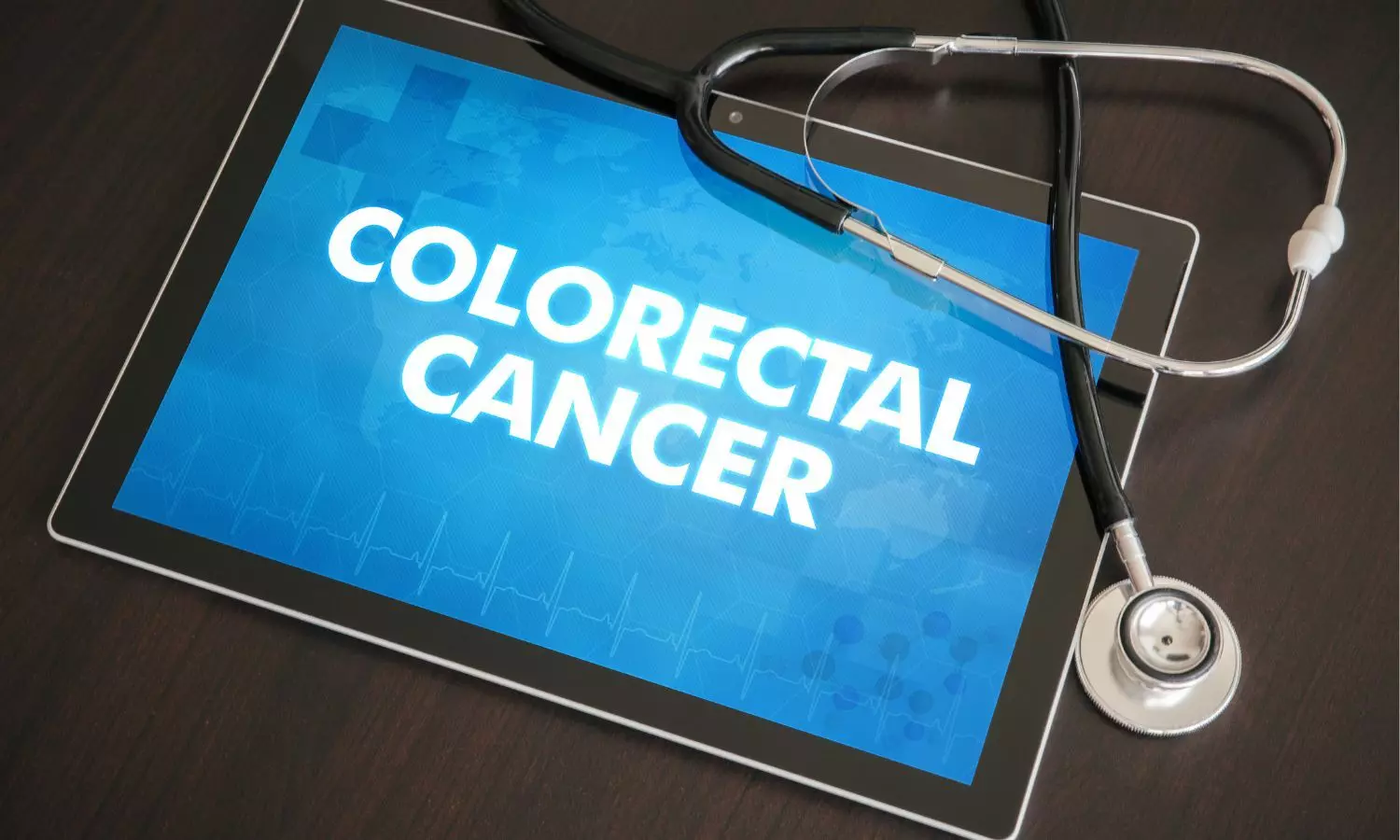 Cholesterol-lowering drugs show promise against colorectal cancer: Study