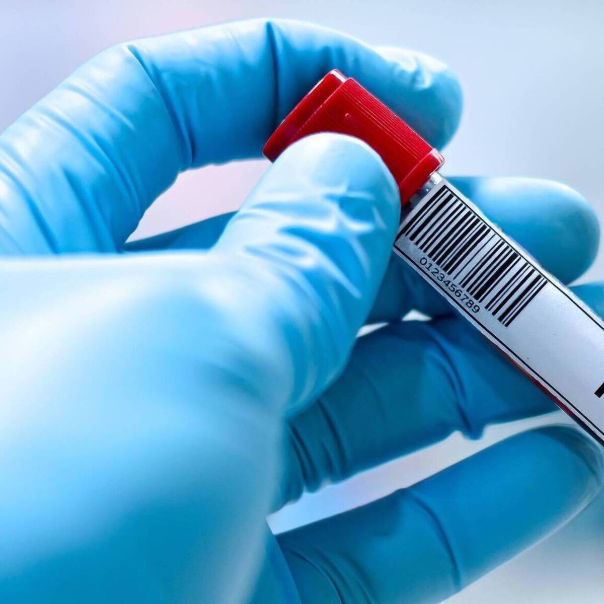 Prostate cancer: Behind the push to perfect screening