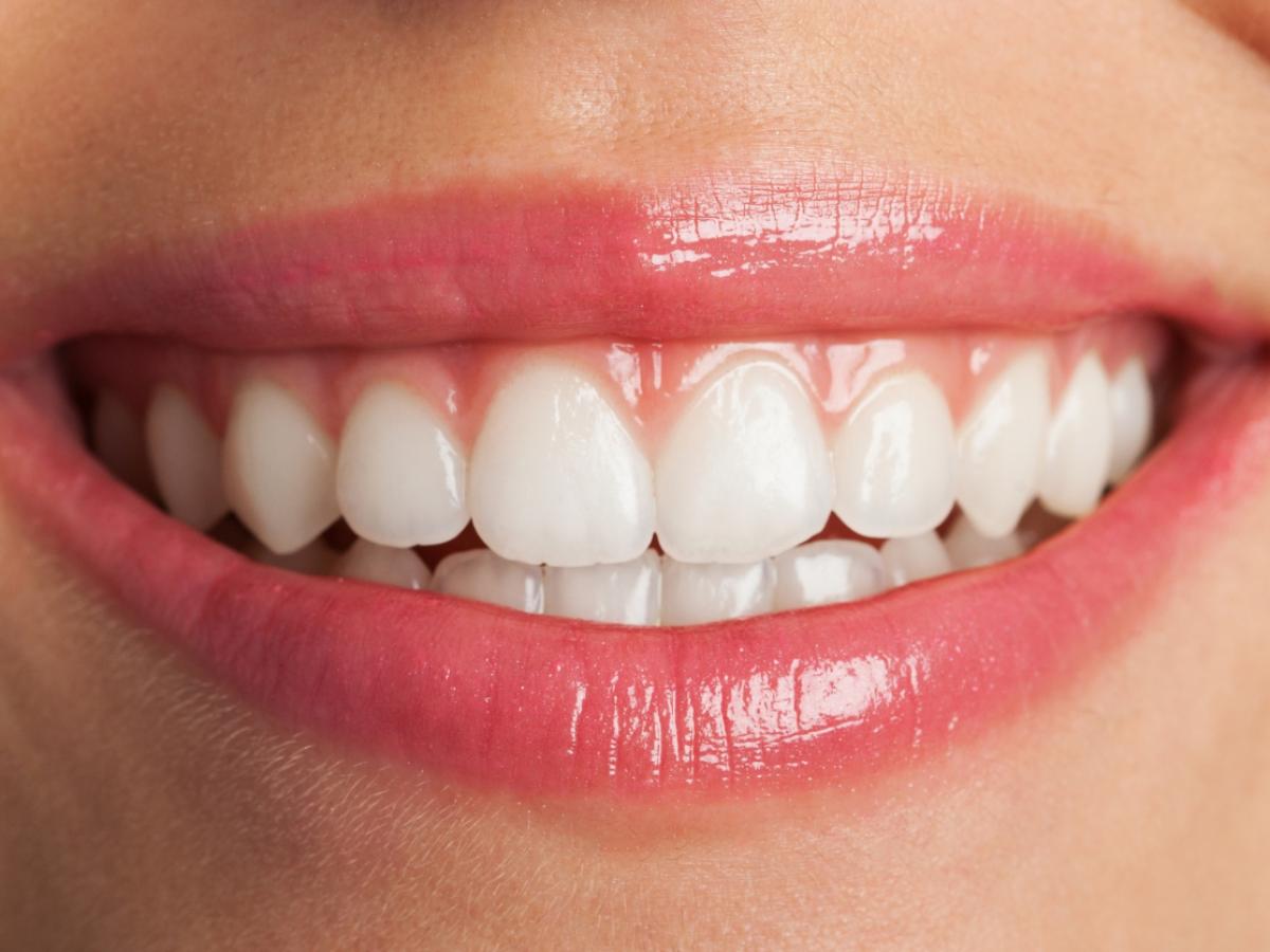Foods That Can Repair Tooth Enamel Naturally
