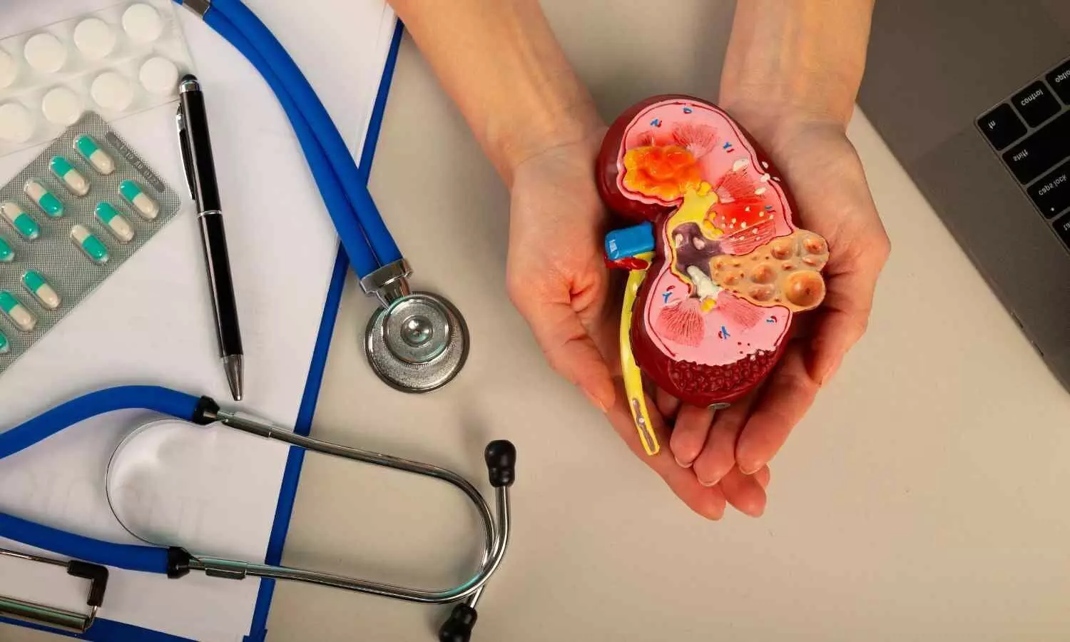 Less can be more: Low-dose steroids could effectively treat severe kidney inflammation,  suggests study