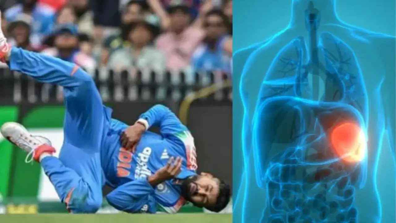 Spleen Laceration Explained: The Injury Behind Shreyas Iyer’s Rib Cage Trauma