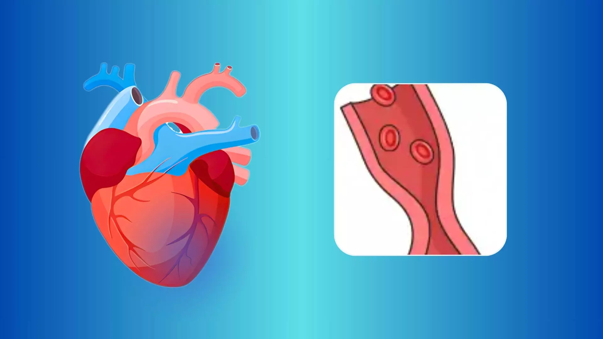 Treatment in Myocardial Infarction and Non-Obstructive Coronary Arteries (MINOCA): PROMISE Trial, TCT 2025