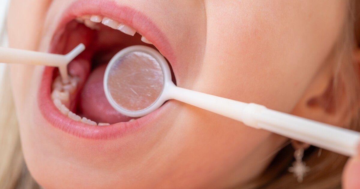 FDA halts sale of unapproved fluoride prescriptions for young children