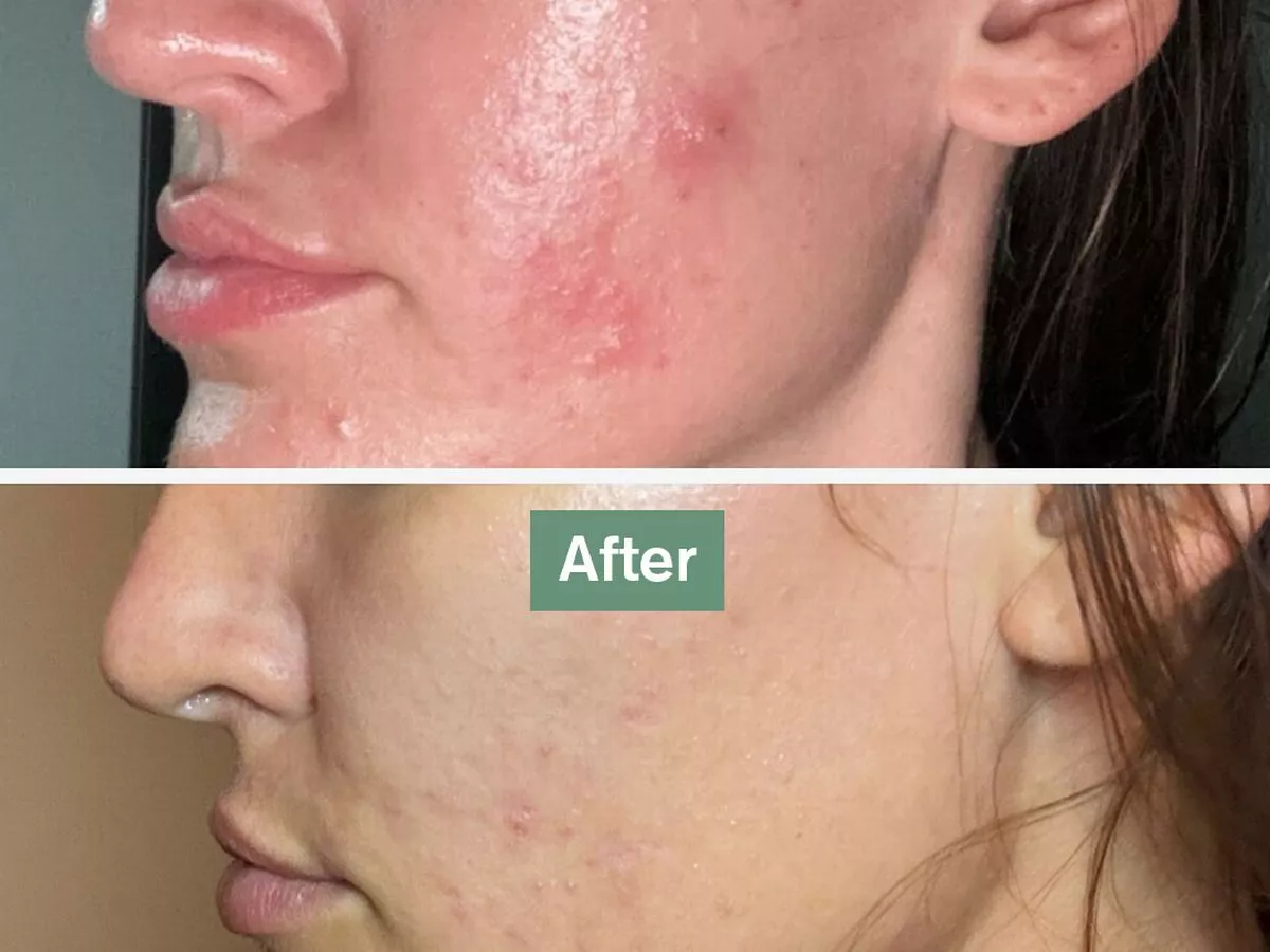 61p-a-day tablets reduce 'wrinkles' and 'bags under my eyes disappeared' in shoppers