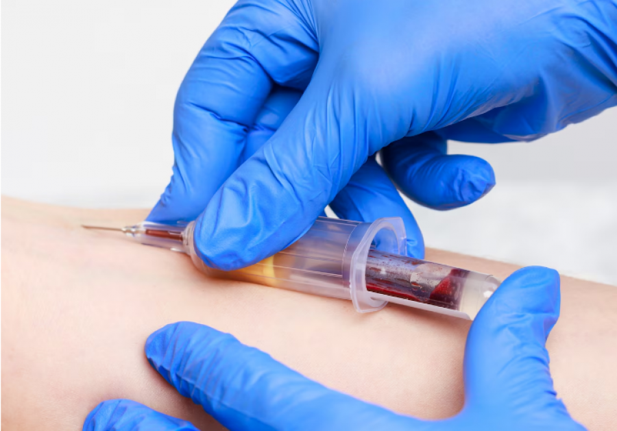 Gratë po i drejtohen testosteronit për t’u ndierë më të reja