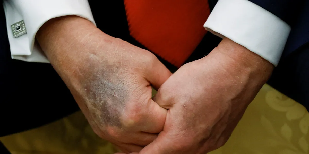 'Not routine': Medical expert wonders what was 'deliberately left out' of Trump MRI disclosure