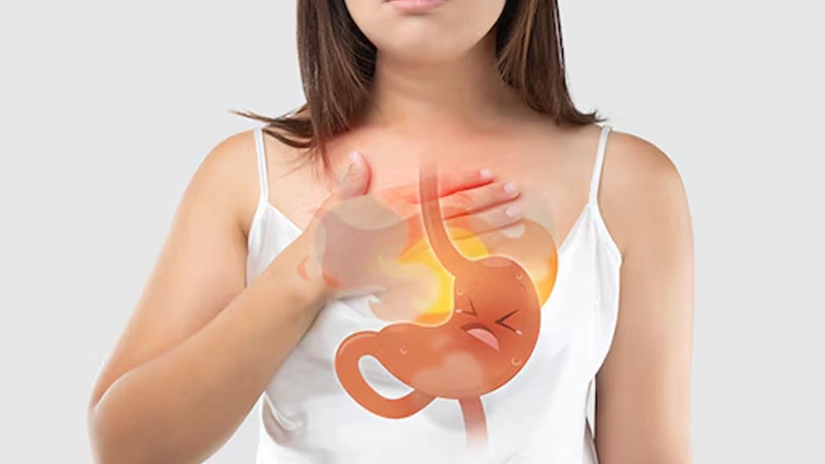 Health Tips : खट्टी डकार और जलन से मिल सकती है राहत, बस अपनाएं ये आसान घरेलू नुस्खे