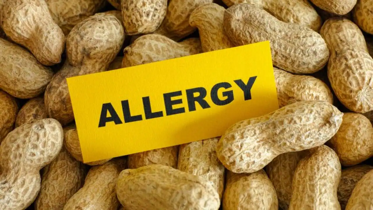 Infant peanut feeding prevented thousands of children from developing allergies