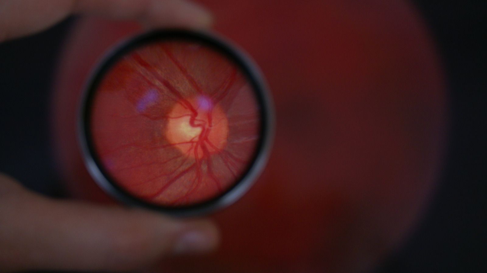 This Electronic Eye Implant Can Now Restore Vision For Some Patients