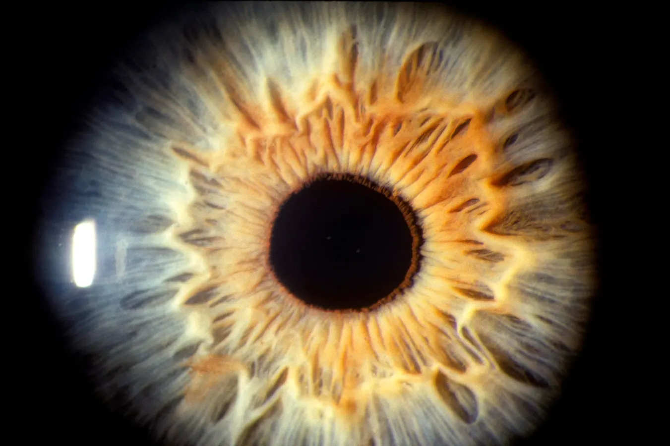 The Eye Exam Is Becoming An AI Exam