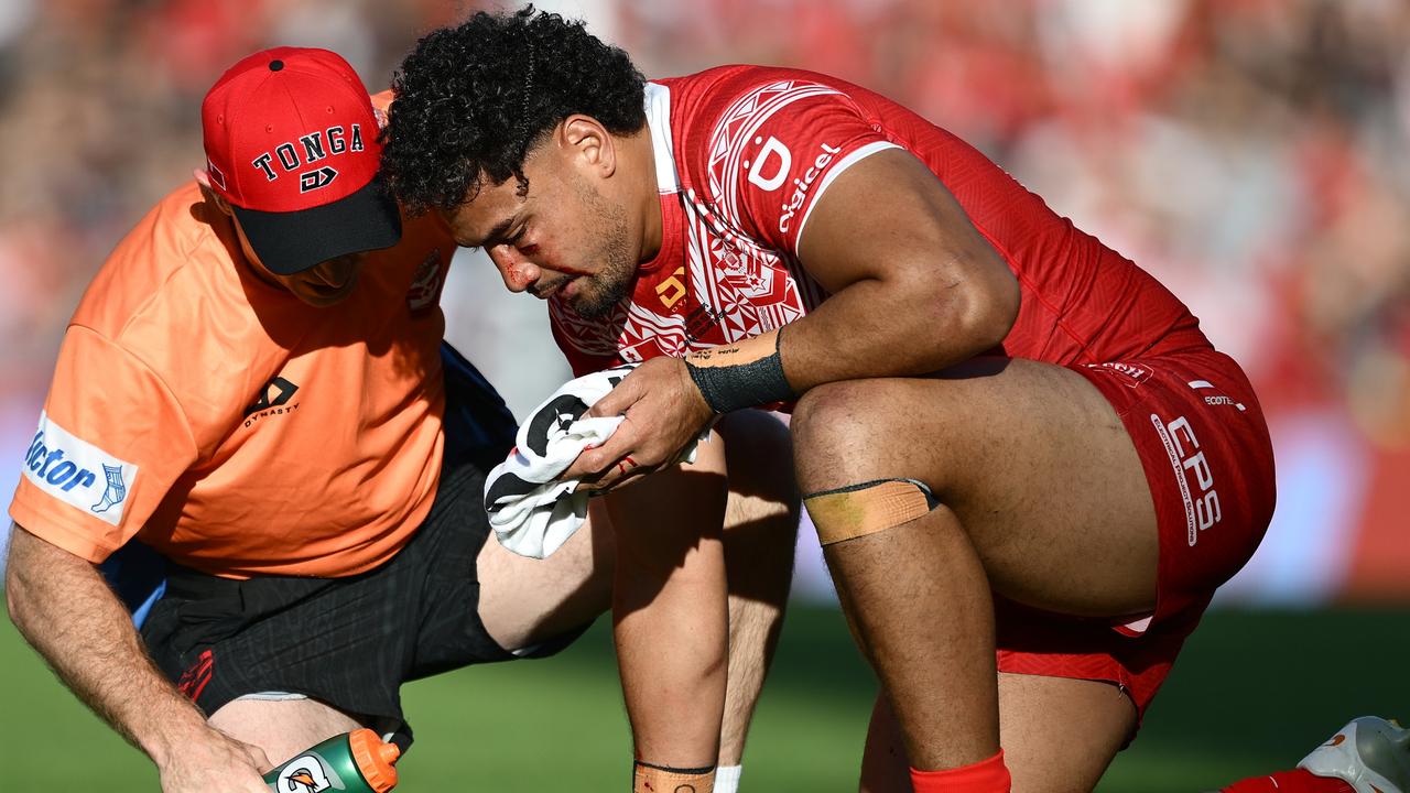Tonga slammed for Katoa call after sickening clash