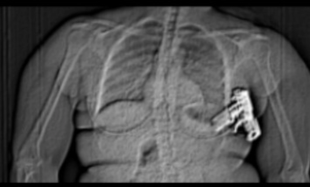 Georgia woman gets time behind bars for smuggling gun into Michigan jail via bra