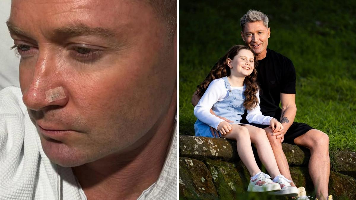 Australian cricket legend Michael Clarke opens up on skin cancer battle after latest surgery