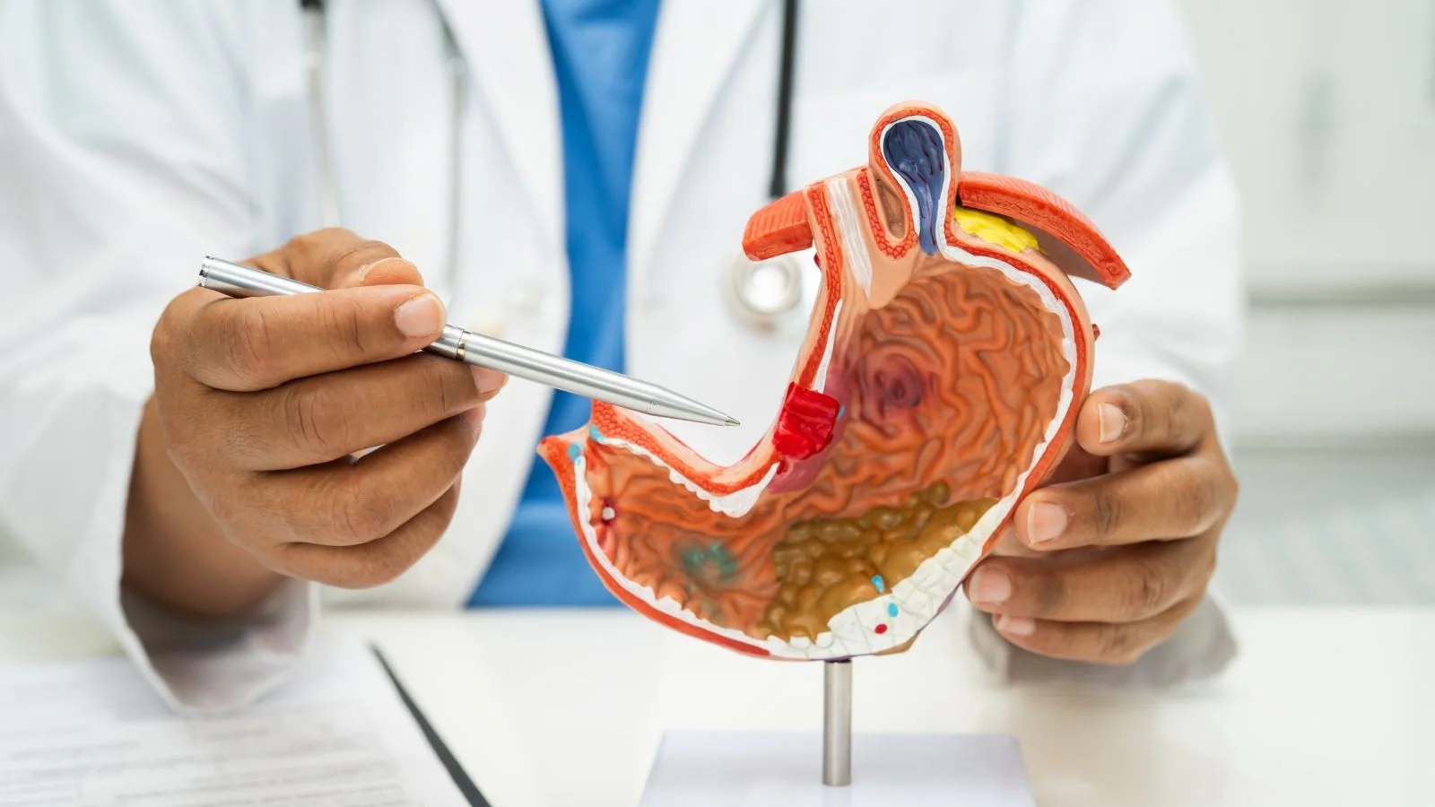 I Never Thought Stress Could Affect My Stomach: How Lifestyle Affects Ulcers