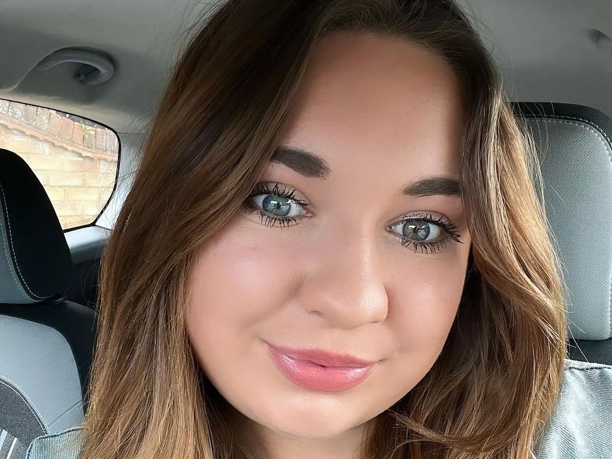 I blamed my moon face on too many dates but truth was more sinister