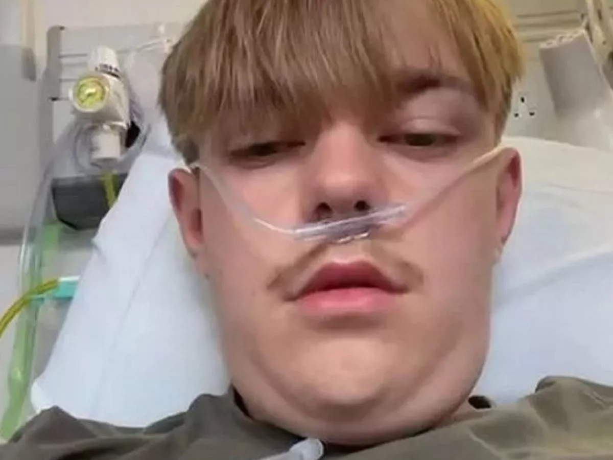 Parents warned as Shropshire teen, 17, coughs blood after trying to 'fit in'