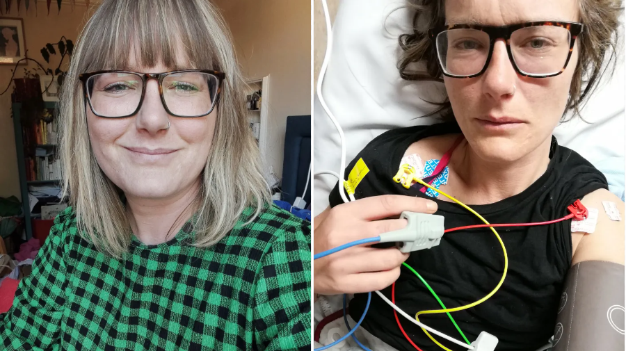 I’ve survived deadly sepsis six times — one symptom always raises the alarm