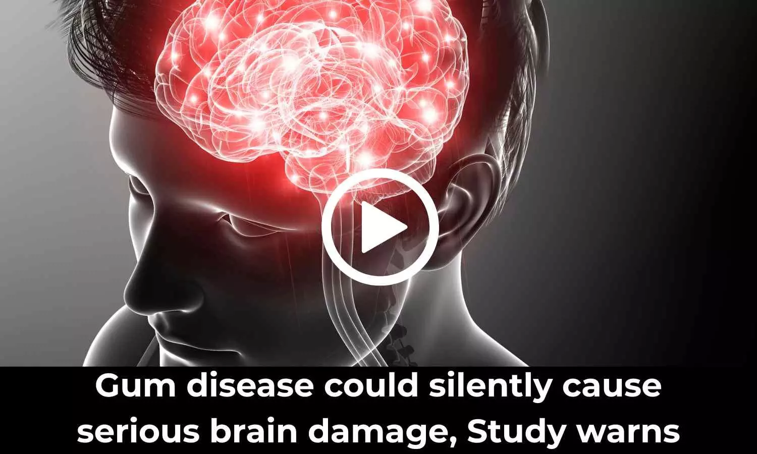 Gum disease could silently cause serious brain damage, Study warns