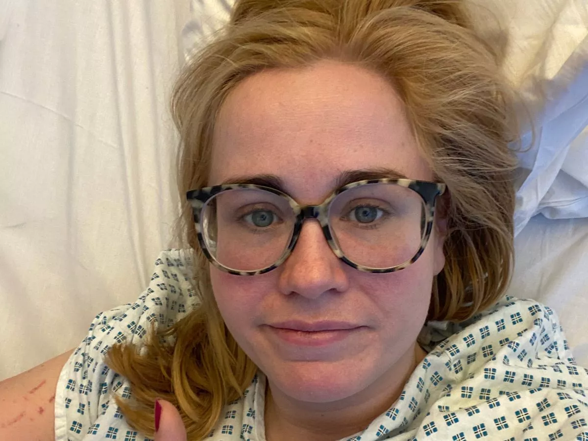 'I thought I had a migraine, then my skin turned tomato red'