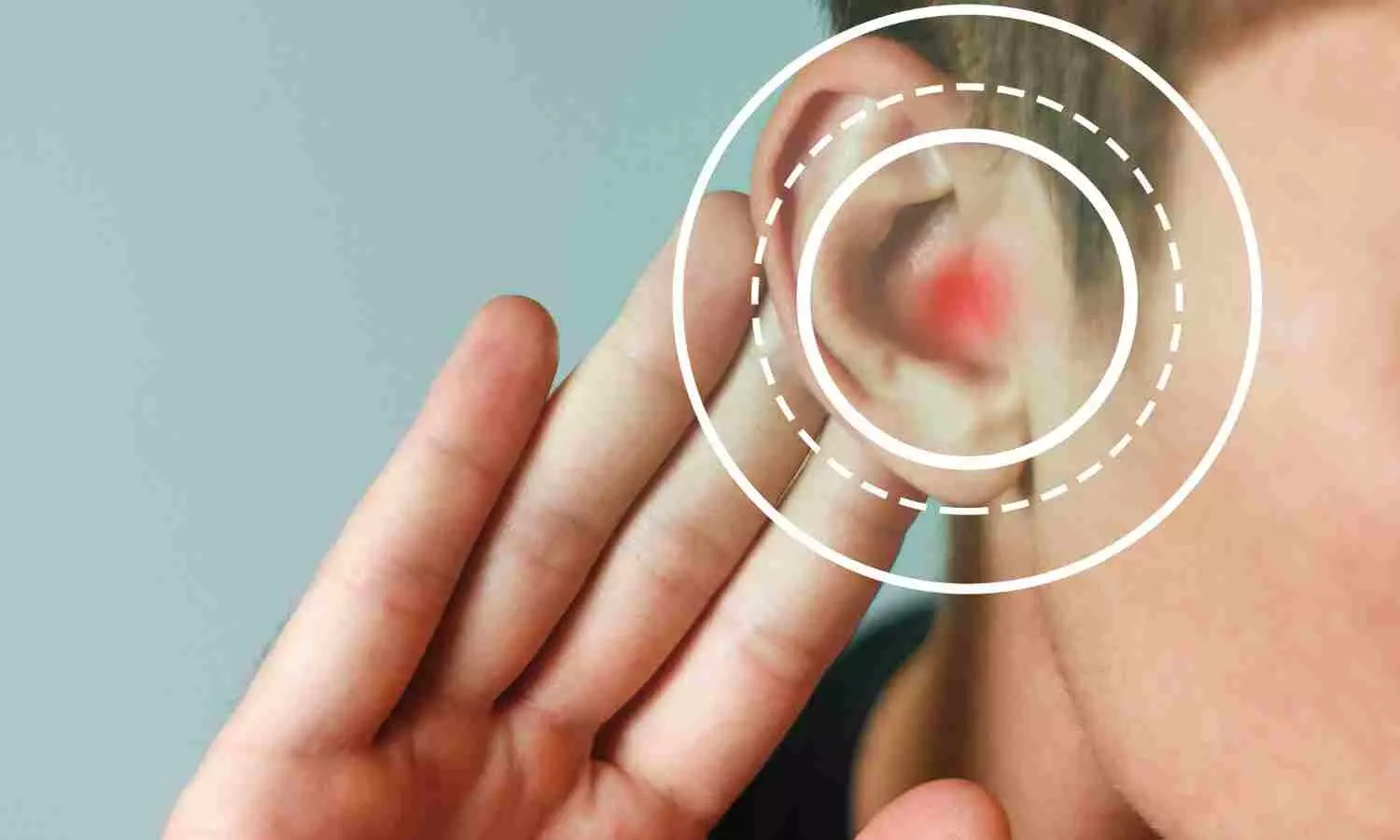 Novel gene therapy for hereditary hearing loss developed at Tel Aviv University, claims research