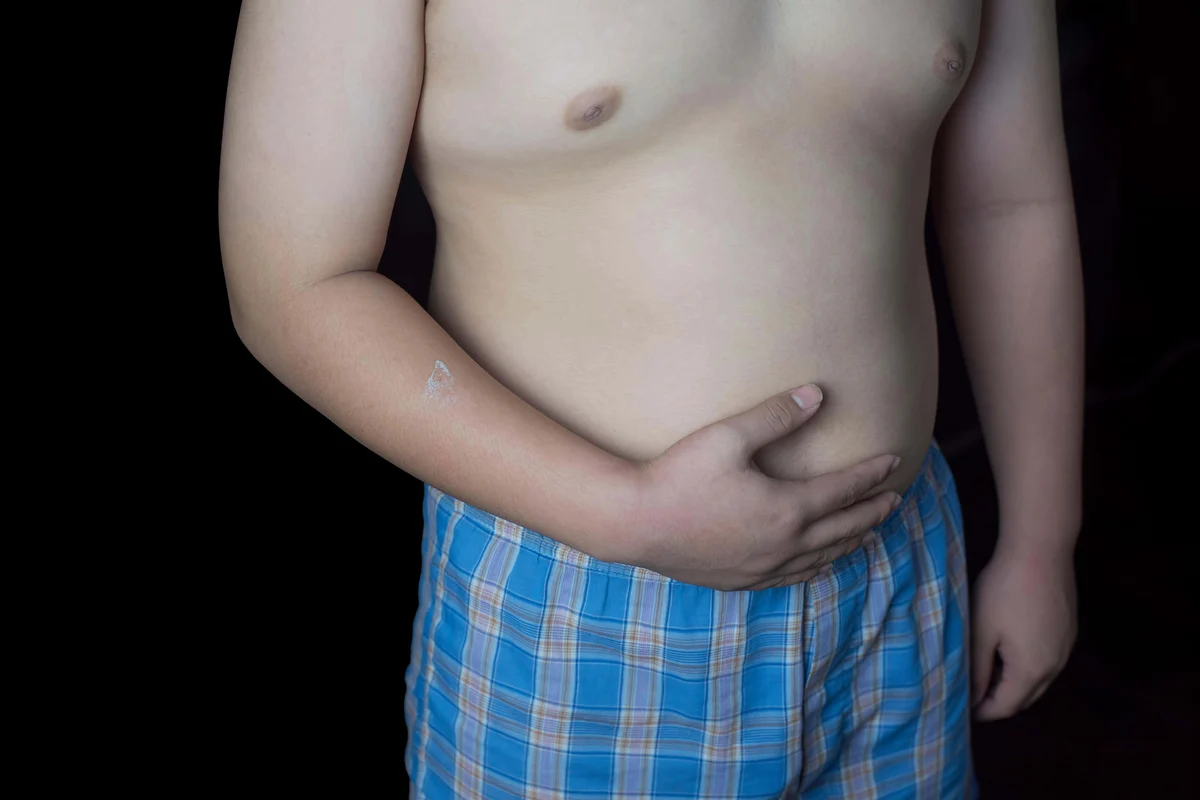 One in 10 children in first year of primary school in England is obese