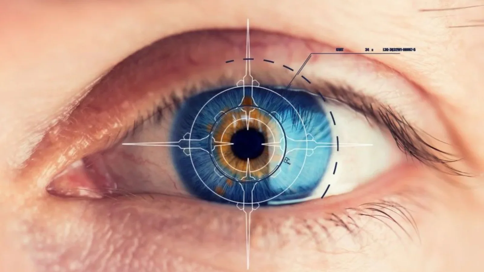 How Young Diabetics Can Prevent Early Retinal Damage?