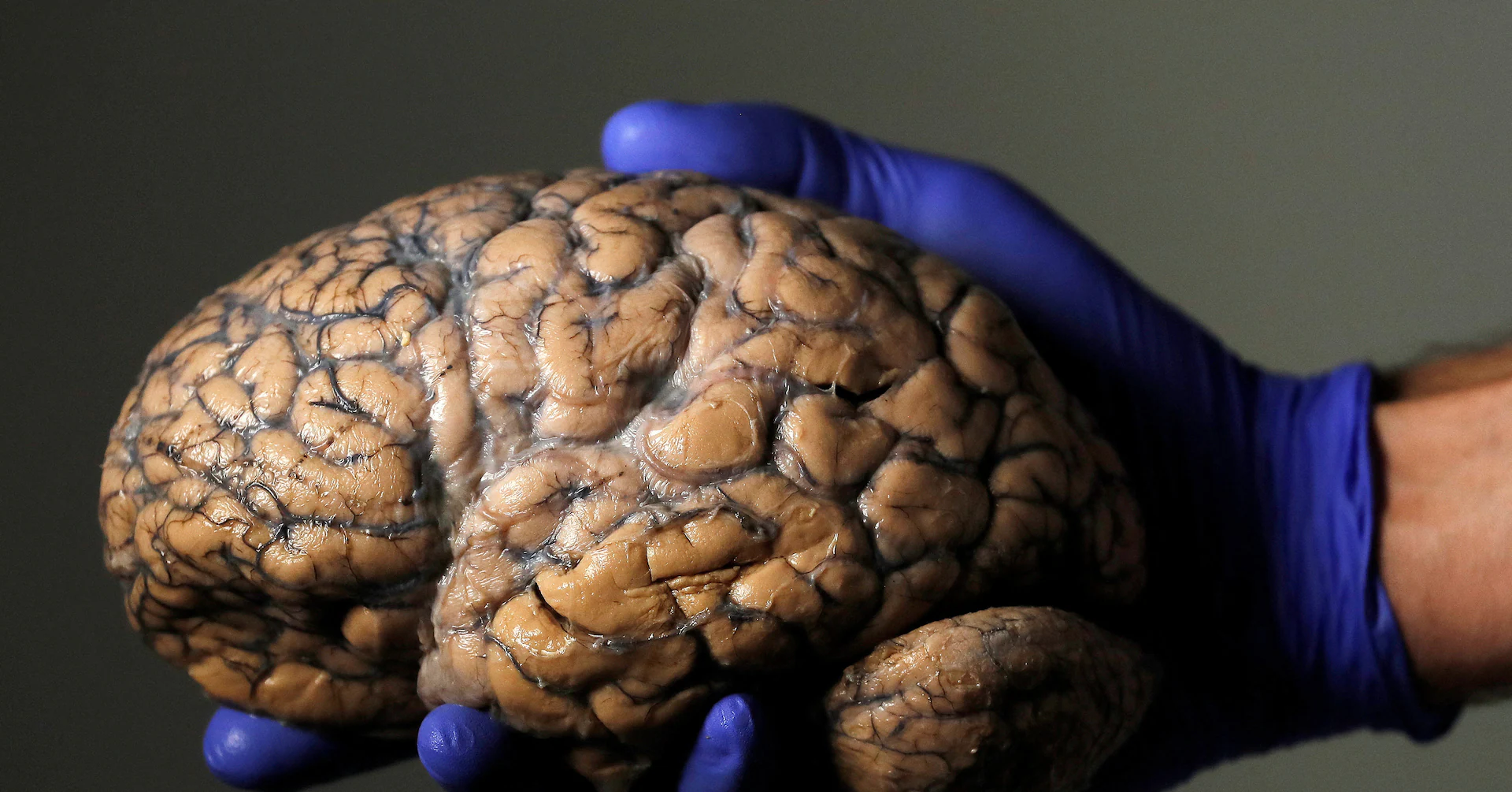 Scientists unveil first draft of atlas of the developing brain