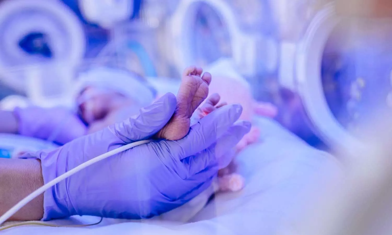 Inhaled Isoflurane Matches Midazolam for Pediatric ICU Sedation, Offers Additional Benefits: Study