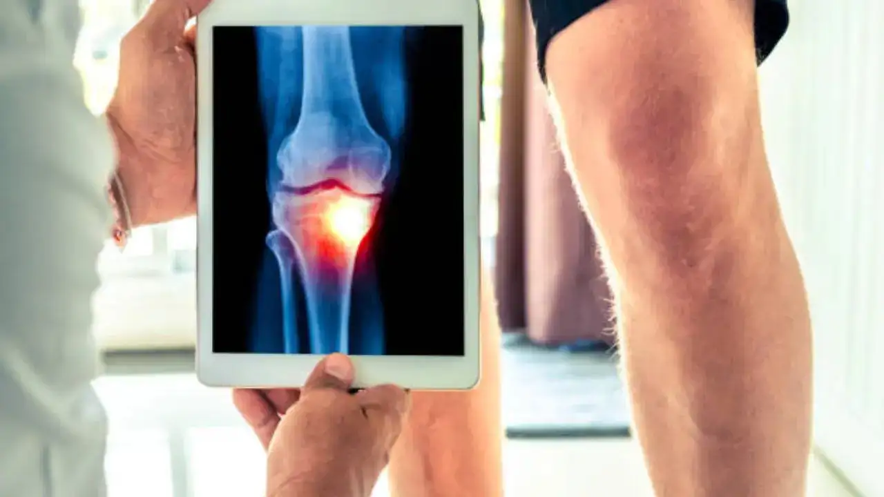Harvard-Backed Three Simple and Natural Ways to Ease Knee Pain and Arthritis